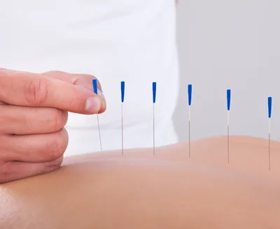javier antar servicios acupuntura